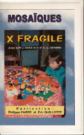 Vidéo «X Fragile»